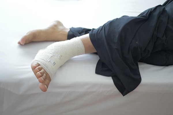 Post Fracture