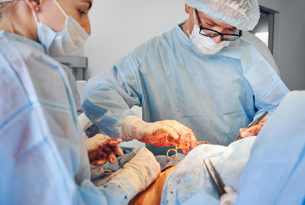 Gall Bladder Surgery